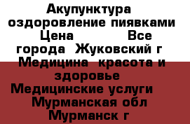 Акупунктура, оздоровление пиявками › Цена ­ 3 000 - Все города, Жуковский г. Медицина, красота и здоровье » Медицинские услуги   . Мурманская обл.,Мурманск г.